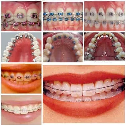 871-orthodontics-insight.