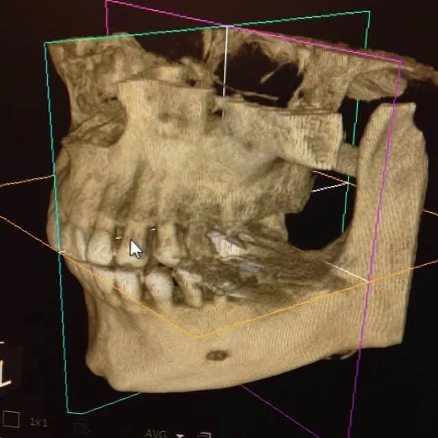 1642-3d-x-rays-in-orthodo